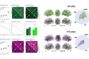 Simulador de actividad cerebral contra enfermedades neurodegenerativas