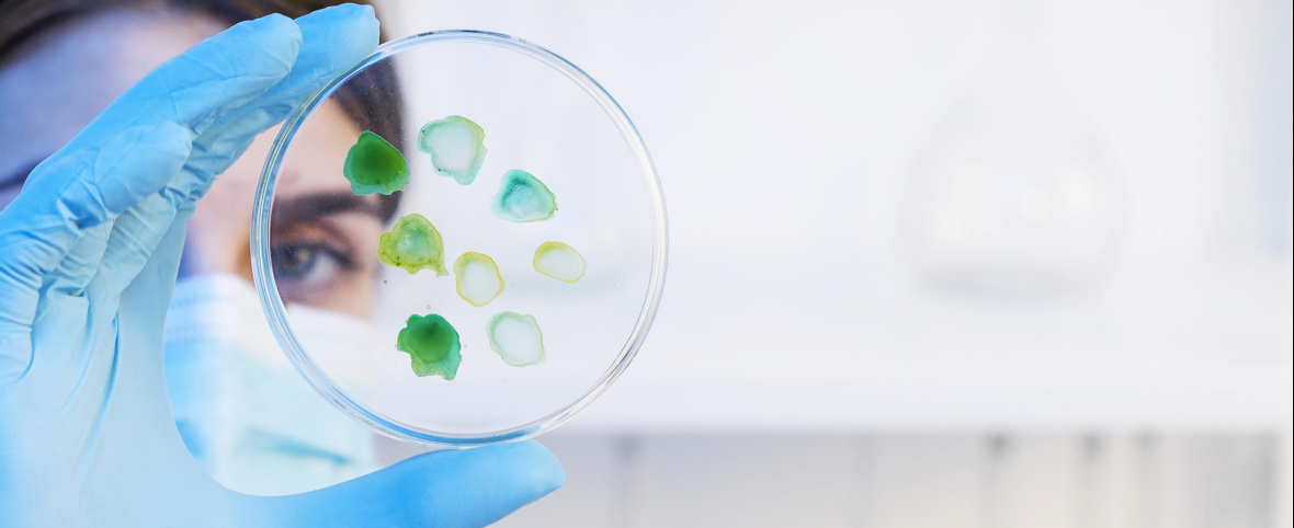 Superbacterias en Argentina: la mortalidad duplica a la de países desarrollados y expone fallas del sistema de salud