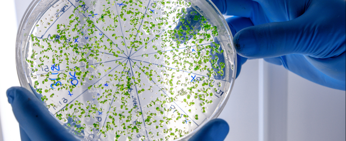 El límite de los antibióticos: por qué crece la preocupación por las bacterias resistentes