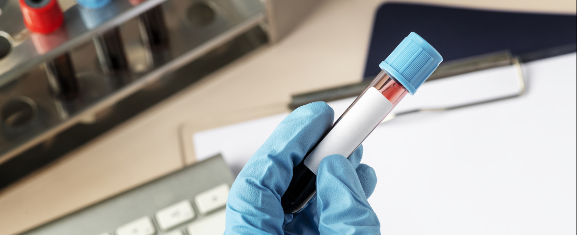 AHF y la OPS se alían para fortalecer el diagnóstico temprano del VIH en América Latina