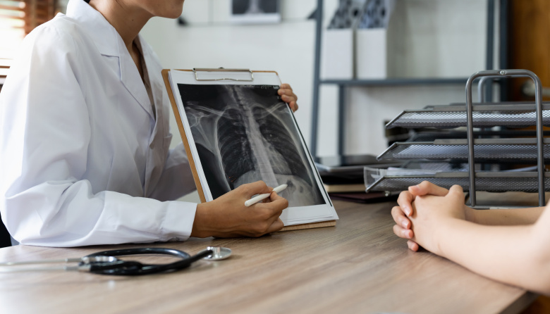 Más de 10.000 muertes por año: un nuevo tratamiento abre una oportunidad frente al cáncer de pulmón