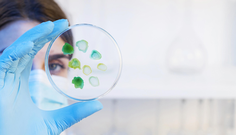 Superbacterias en Argentina: la mortalidad duplica a la de países desarrollados y expone fallas del sistema de salud