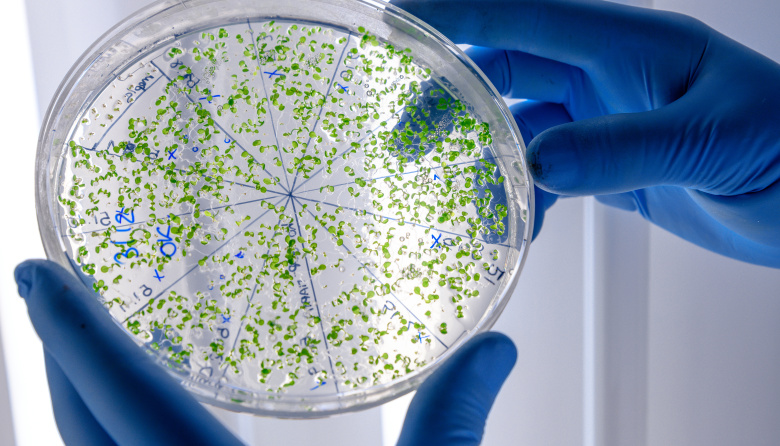 El límite de los antibióticos: por qué crece la preocupación por las bacterias resistentes