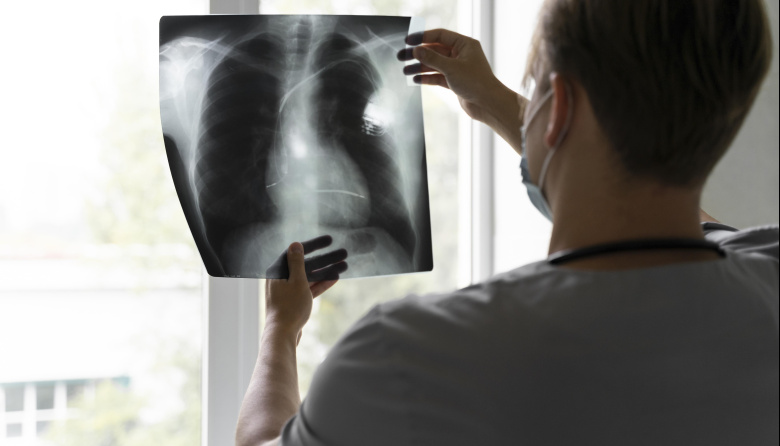 ¿Qué significa el aumento de la tuberculosis?