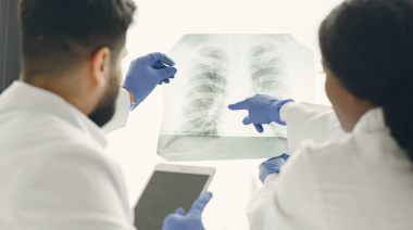 Aumentan los casos de tuberculosis y alertan sobre diagnóstico tardío
