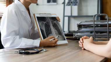 Más de 10.000 muertes por año: un nuevo tratamiento abre una oportunidad frente al cáncer de pulmón