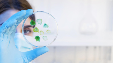 Superbacterias en Argentina: la mortalidad duplica a la de países desarrollados y expone fallas del sistema de salud