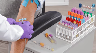 Por qué la calidad también se define en la fase preanalítica