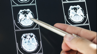 Meningitis: aumentan los casos y preocupa la caída en la vacunación adolescente