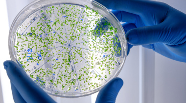 El límite de los antibióticos: por qué crece la preocupación por las bacterias resistentes