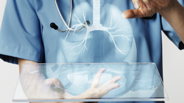 El cáncer silencioso que pone a prueba a los sistemas de salud