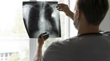 ¿Qué significa el aumento de la tuberculosis?