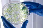 El límite de los antibióticos: por qué crece la preocupación por las bacterias resistentes