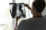 ¿Qué significa el aumento de la tuberculosis?
