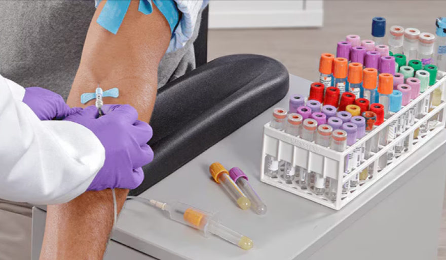 Por qué la calidad también se define en la fase preanalítica